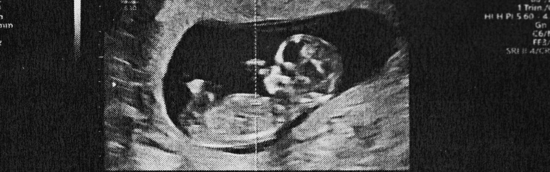 Pregnancy scan image